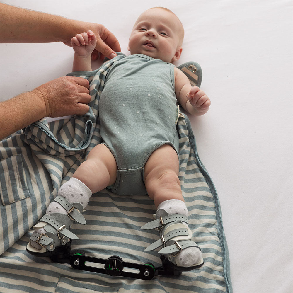 Baby lying on a striped blanket with Hip Dysplasia brace in a woolbabe Sleeping Bag