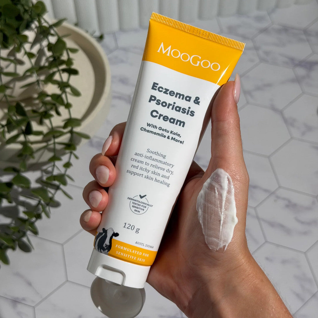 A hand holding a tube of Eczema & Psoriasis Cream.