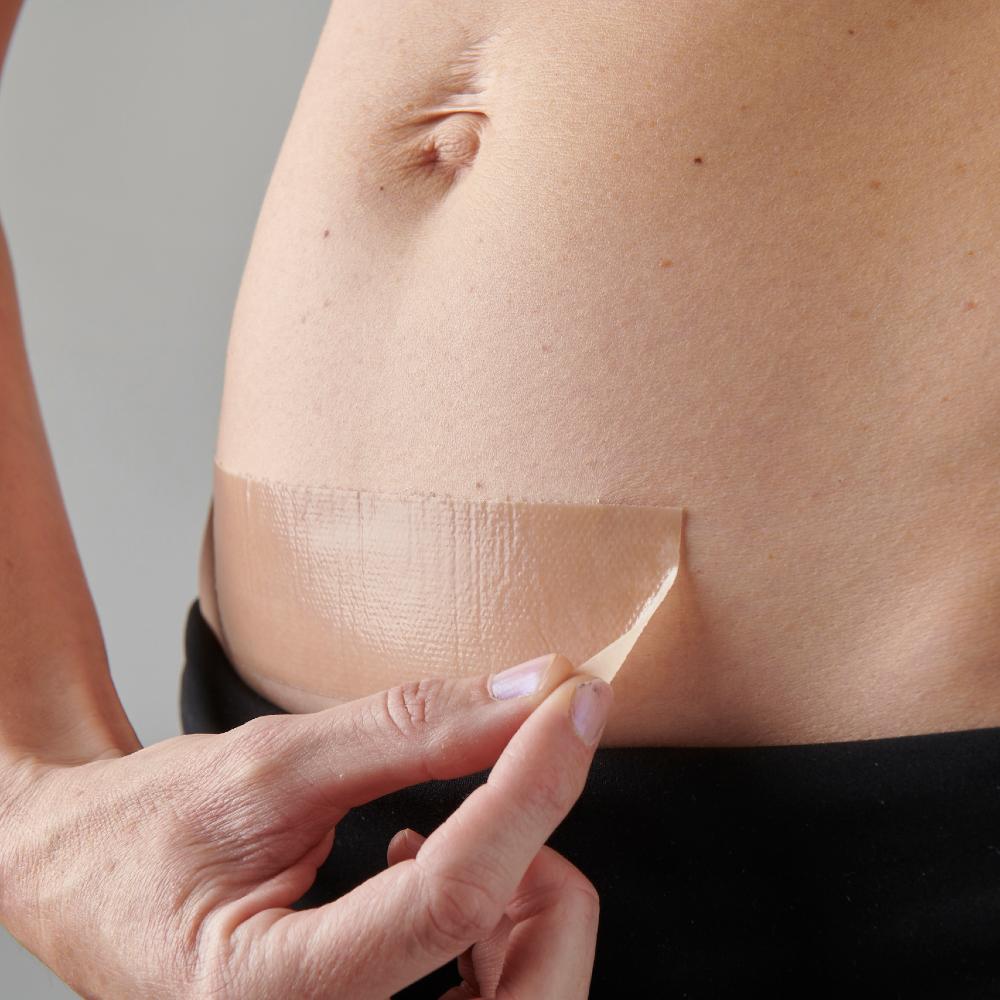 The Original Caesarean Silicone Strips