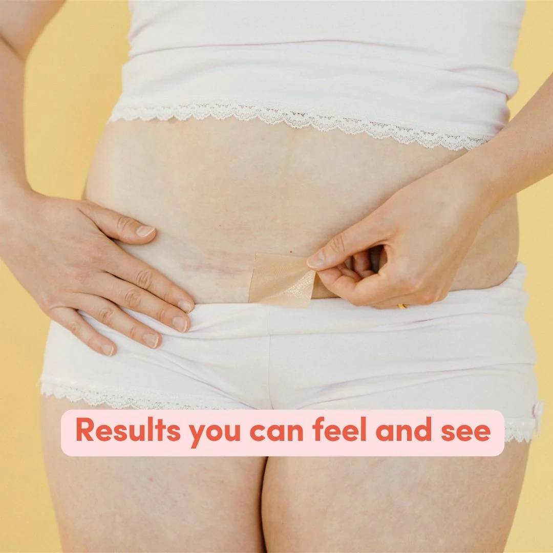 Vital Bits C-Section Scar Patches 6pk