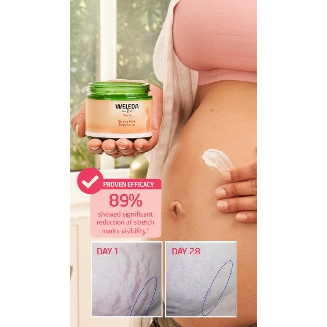Stretch Mark Body Butter